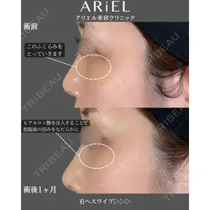アリエル美容クリニック 郡山院の症例