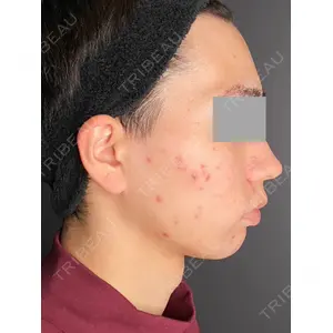Wi Clinic（ウィ クリニック） 大宮院の症例