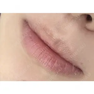しんゆり美容健康クリニックの症例
