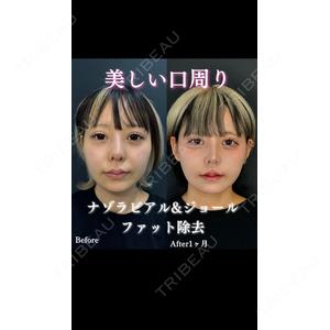 ルラ美容クリニック 渋谷本院 住友 沙織医師の症例