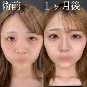 HAAB×DREAM BEAUTY CLINIC 大阪梅田院 柏木 太雅医師の症例