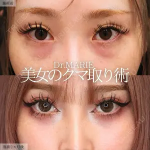 銀座TAクリニック 山田 真里江医師の症例