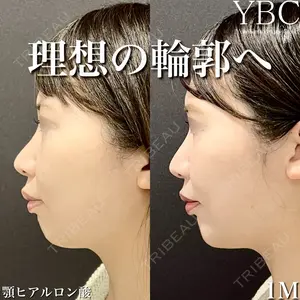 YBC横浜美容外科 大宮院 磯村 亮輔医師の症例
