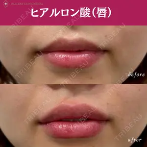 ギャラリークリニック 銀座の症例