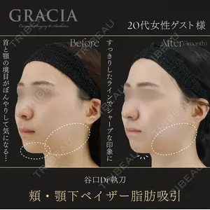 GRACIA clinic 【グラシアクリニック】の症例