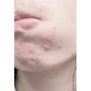 しんゆり美容健康クリニックの症例