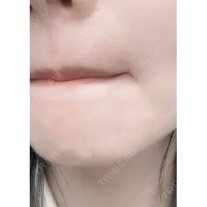 しんゆり美容健康クリニックの症例