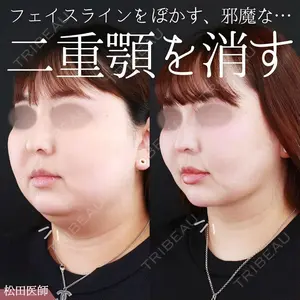 大阪TAクリニック 松田 由美医師の症例