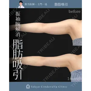 東京シンデレラ美容外科 大宮院の症例