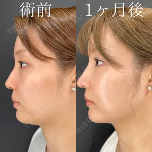 HAAB×DREAM BEAUTY CLINIC 大阪梅田院 鈴木 馨斗医師の症例