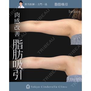 東京シンデレラ美容外科 大宮院の症例
