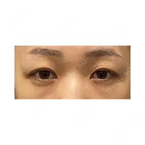 Wi Clinic（ウィ クリニック） 大宮院の症例