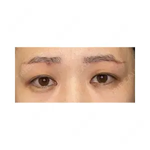 Wi Clinic（ウィ クリニック） 大宮院の症例