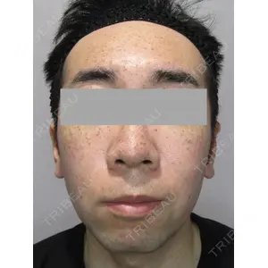 Wi Clinic（ウィ クリニック） 大宮院の症例