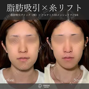 PRISM Beauty Clinic 畑山 知輝医師の症例