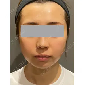 Wi Clinic（ウィ クリニック） 大宮院の症例