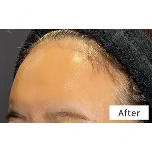Wi Clinic（ウィ クリニック） 銀座院の症例