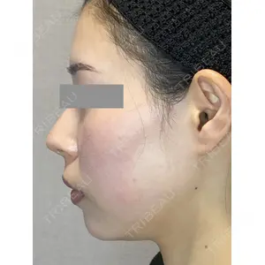 Wi Clinic（ウィ クリニック） 銀座院の症例