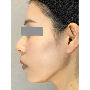 Wi Clinic（ウィ クリニック） 銀座院の症例