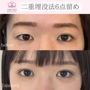 オーキッド美容クリニック東京御徒町 西浦 蘭子医師の症例