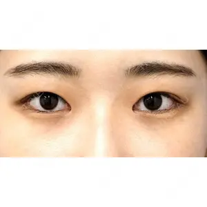もとび美容外科クリニック 新宿院 西尾 謙三郎医師の症例