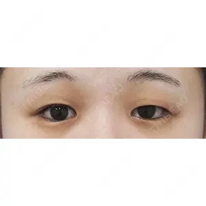 もとび美容外科クリニック 新宿院 西尾 謙三郎医師の症例