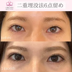 オーキッド美容クリニック東京御徒町 西浦 蘭子医師の症例