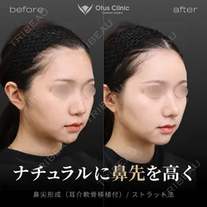 Otus Clinic 【オータスクリニック】 中 徳太郎医師の症例