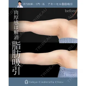東京シンデレラ美容外科 大宮院の症例