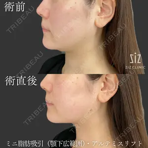 ziz CLINICの症例