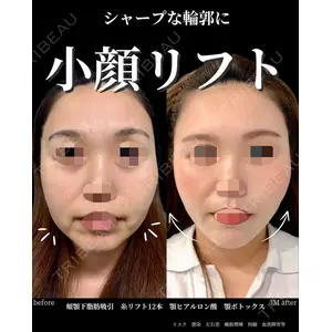 グローバルビューティークリニック 大阪院の症例