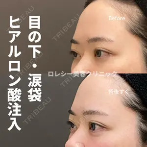 ロレシー美容クリニック 心斎橋駅前院 高田先生医師の症例