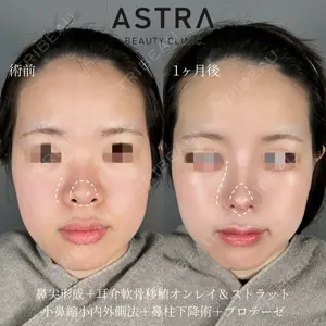 ASTRA BEAUTY CLINIC 塩満 惠子医師の症例