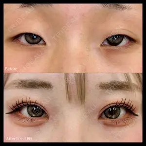INO BEAUTY CLINIC 井上 紘基医師の症例
