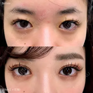 INO BEAUTY CLINICの症例