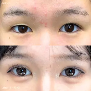 INO BEAUTY CLINICの症例