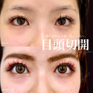 INO BEAUTY CLINICの症例
