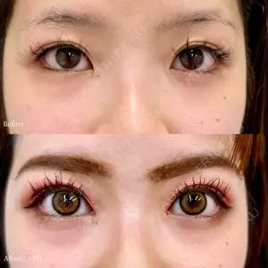 INO BEAUTY CLINICの症例