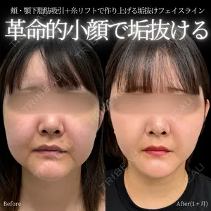 INO BEAUTY CLINICの症例