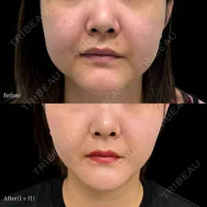 INO BEAUTY CLINICの症例