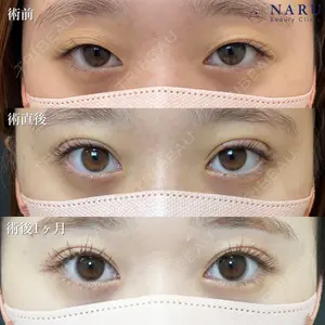 NARU Beauty Clinic 【ナルクリ】 石橋 成彦医師の症例