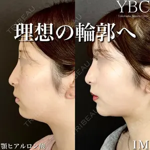 YBC横浜美容外科 大宮院 磯村 亮輔医師の症例