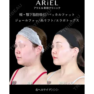 アリエル美容クリニック 大宮院 鈴木　桂介医師の症例