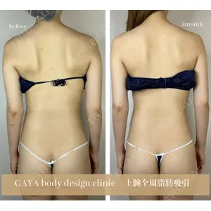 GAYA body design clinic 飯ヶ谷 重来医師の症例