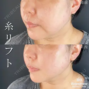 Brandnew Beauty Clinicの症例