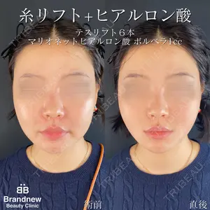 Brandnew Beauty Clinicの症例