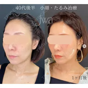自由が丘ウェルエイジングビューティークリニック 福田 知佐子医師の症例