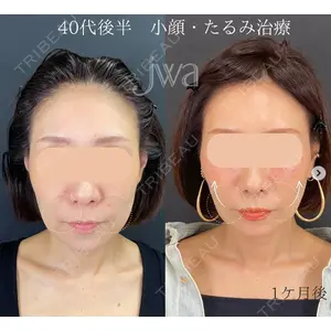 自由が丘ウェルエイジングビューティークリニック 福田 知佐子医師の症例