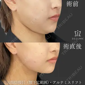 ziz CLINIC 村岡 史子医師の症例