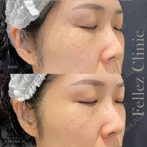 Fellez Clinic【フェルズクリニック】の症例
